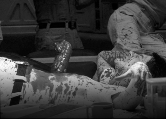 La brutal experiencia de un paciente que recuerda la escena más espeluznante de 'Alien'