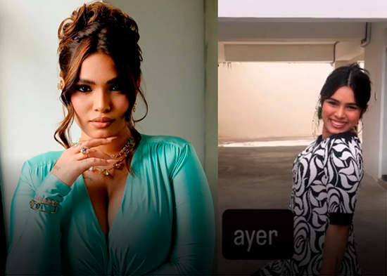 La Ross María muestra los resultados de su operación de reducción de senos por gigantomastia