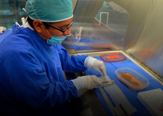 Buscan activar banco de piel en hospital Arturo Grullón