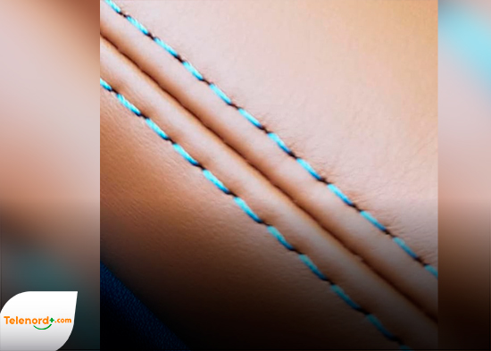 Editorial de NTN: Costura Doble